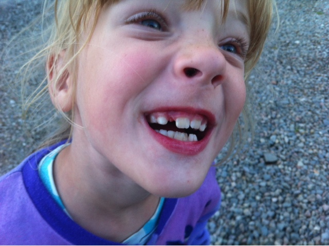 Und der zweite Zahn Und der zweite Zahn